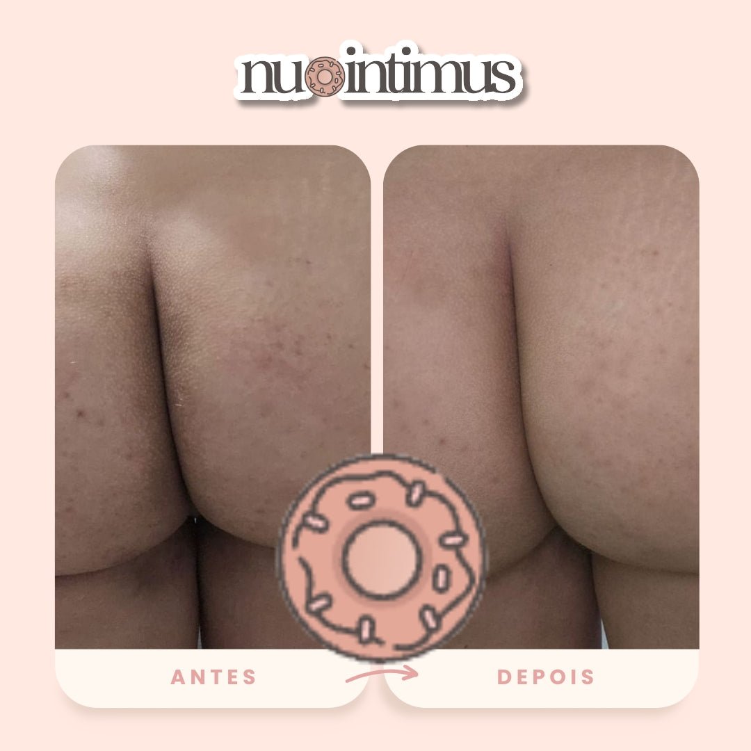 Nu Intimus Creme Clareador Anal - Nanda Intimus
