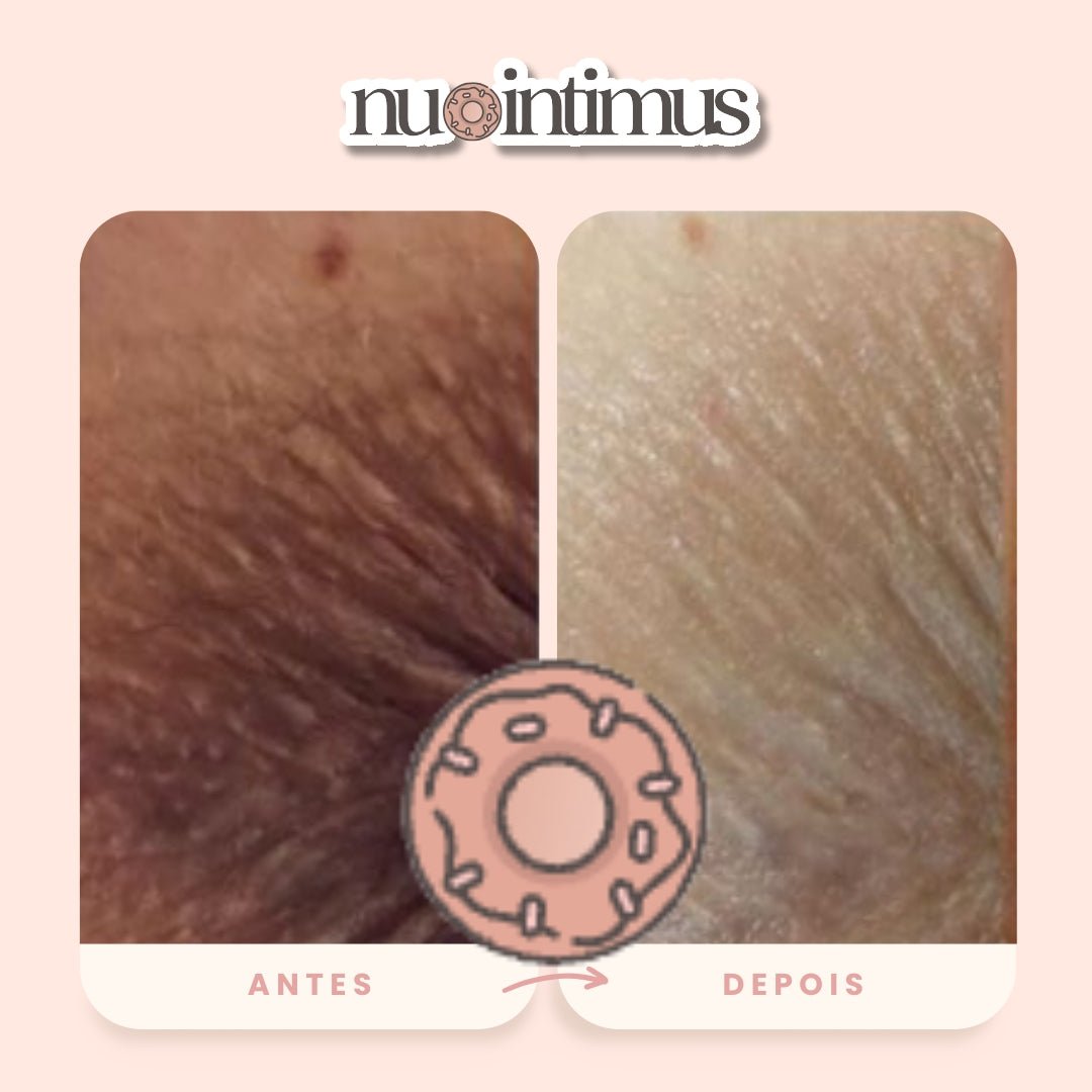 Nu Intimus Creme Clareador Anal - Nanda Intimus