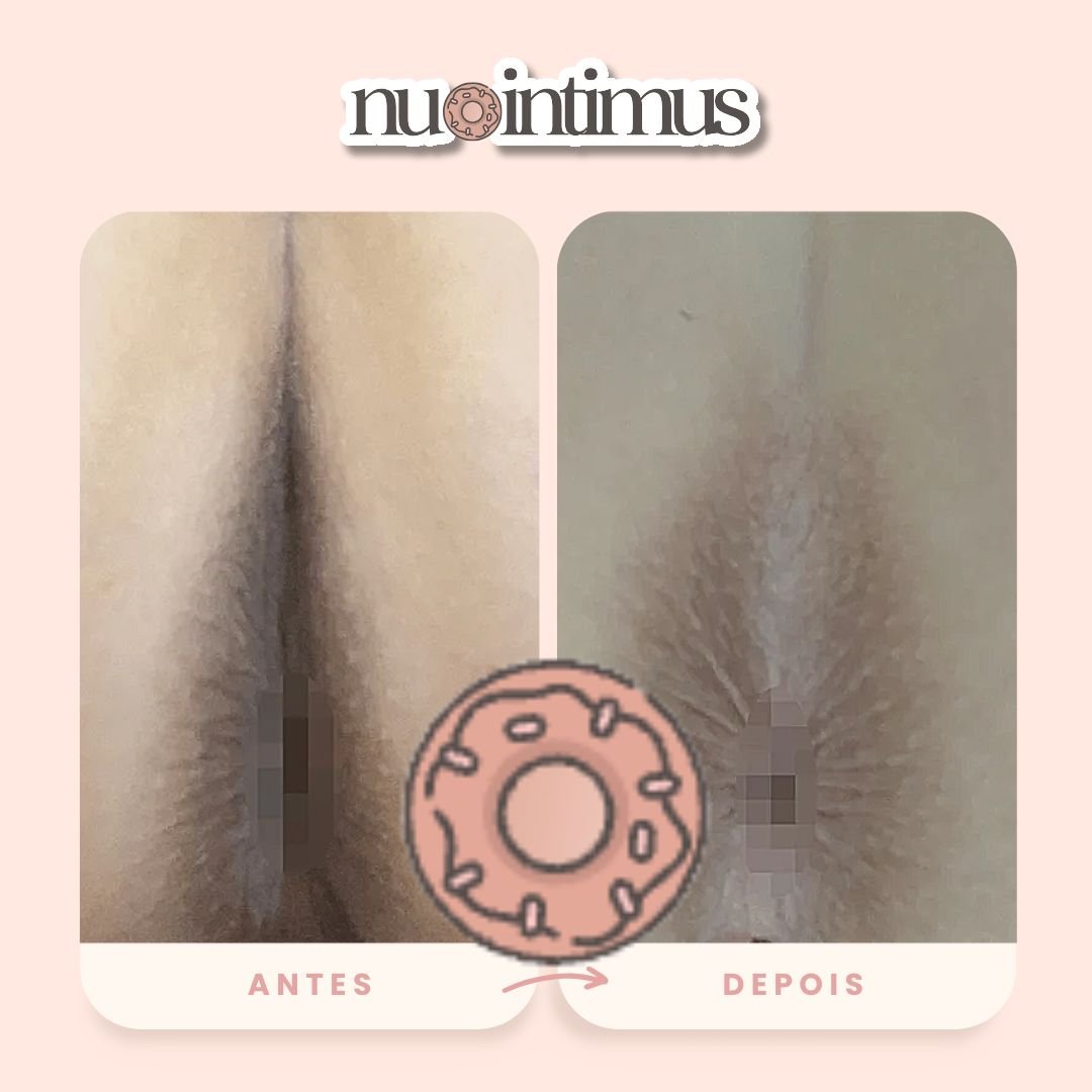Nu Intimus Creme Clareador Anal - Nanda Intimus